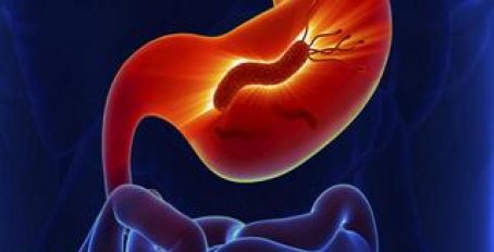 Методы лечения бактерии хеликобактер пилори в желудке